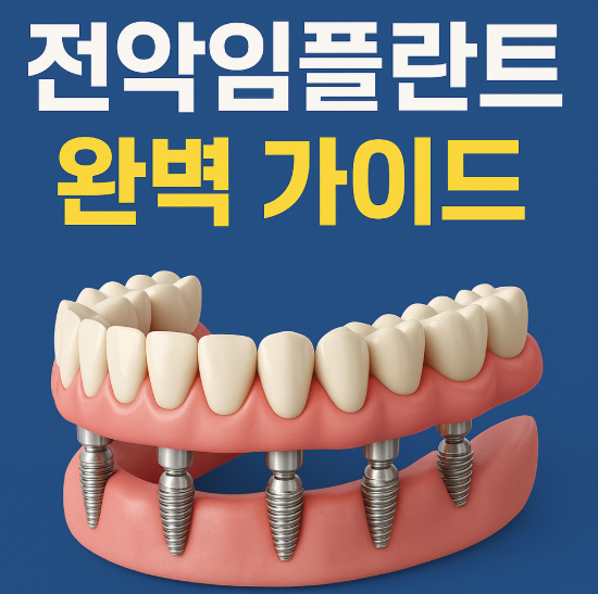 전악임플란트 완벽 가이드: 비용부터 주의사항까지 총정리
